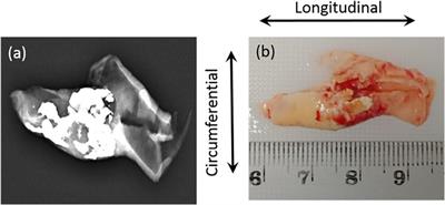 Stress-Relaxation and Cyclic Behavior of Human Carotid Plaque Tissue